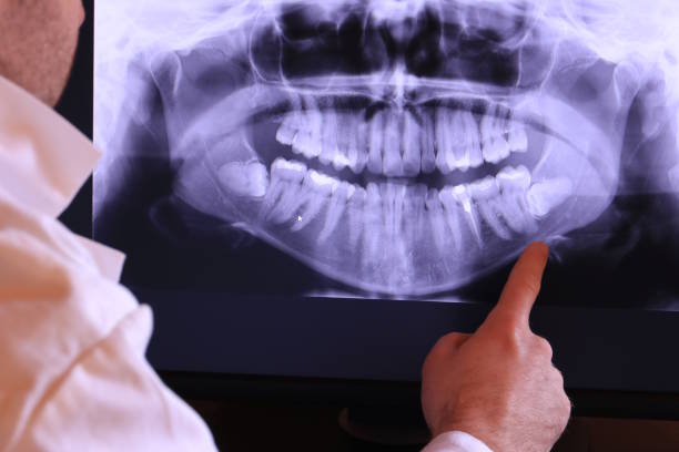 Best Knocked-Out Tooth Emergency  in Central, TN